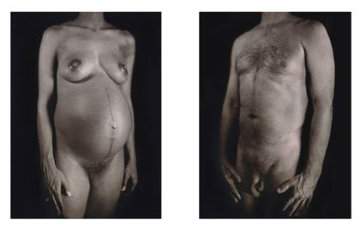 Untitled from Doctors of the World portfolio 2001 HS Limited Edition Print - Chuck Close