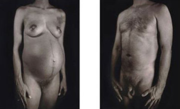Untitled - Man / Woman (From Doctors of the World, Medecins Sans Frontieres Portfolio 2001 Limited Edition Print - Chuck Close Untitled - Man / Woman (From Doctors of the World, Medecins Sans Frontieres Portfolio 2001 Limited Edition Print - Chuck Close
