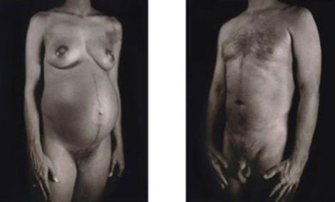Untitled - Man / Woman (From Doctors of the World, Medecins Sans Frontieres Portfolio 2001 Limited Edition Print - Chuck Close