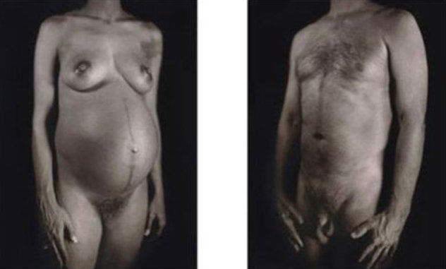 Untitled - Man / Woman (From Doctors of the World, Medecins Sans Frontieres Portfolio 2001 Limited Edition Print by Chuck Close